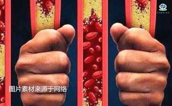 不想給血管“添堵”，盡量少吃以下這些東西，或許能讓腦梗離遠些  